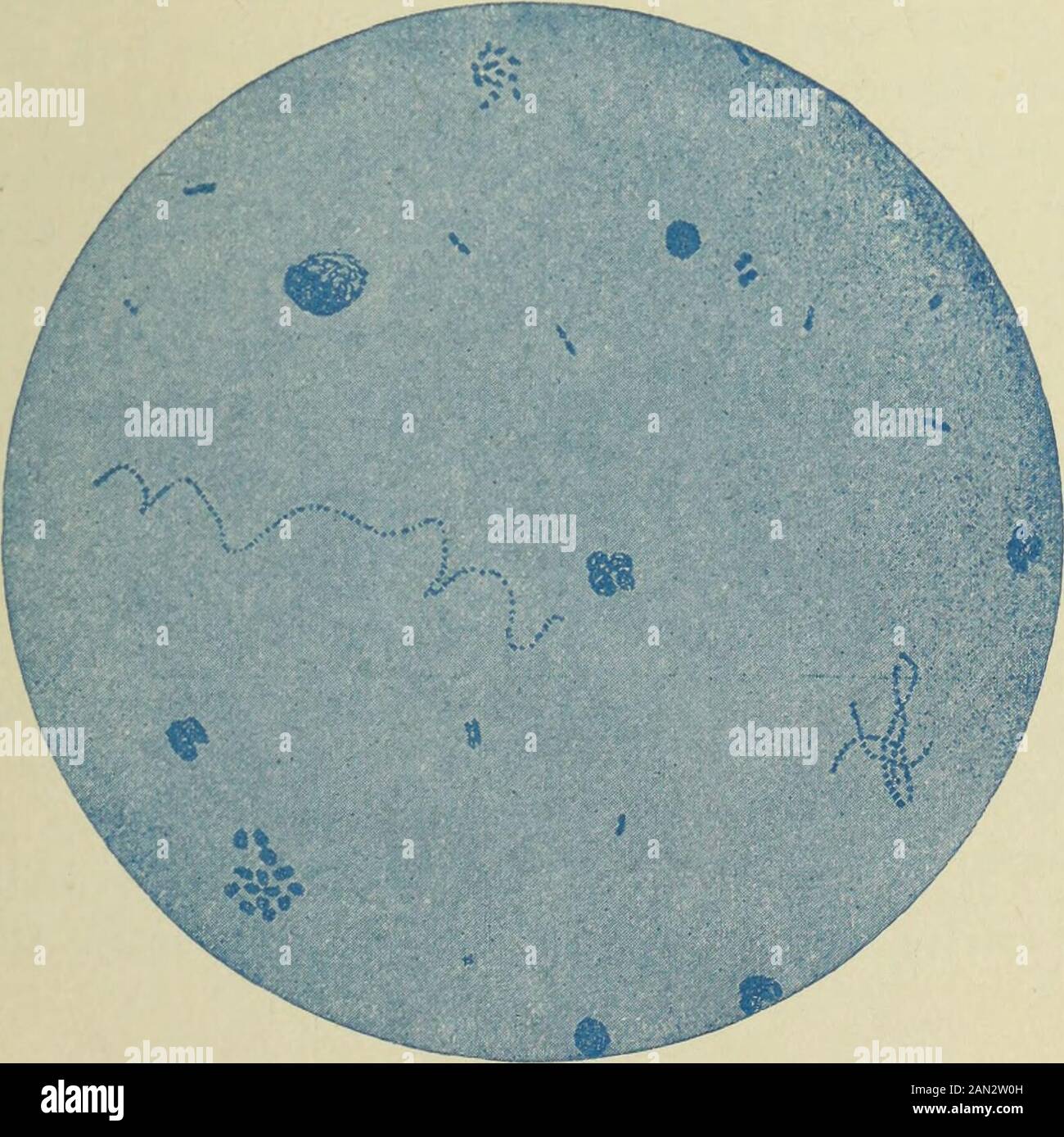 Rapport annuel du Conseil de contrôle de la Station d'expérimentation agricole de New York . Fig. 2.—Deux paires de bactéries lactiques et un seul bacter-ium. Une cellule tissulaire. Nombre de bactéries = 2 000 000 par c. c.numération cellulaire —400 000 par c. LAIT DE MAUVAISE QUALITÉ... Fig. 4.— Le Lait qui est à la fois de qualité insalubre et suspecte. Sept cellules tissulaires. Nombre de bactéries = 100 000 000 par c. Nombre de cellules = 2 800 000 par c. Station D'Expérimentation Agricole De New York. 85 méthode de la plaque.— le milieu utilisé dans ces comparativetestes était une gélose au lactose, faite selon la formule suivante: T Banque D'Images