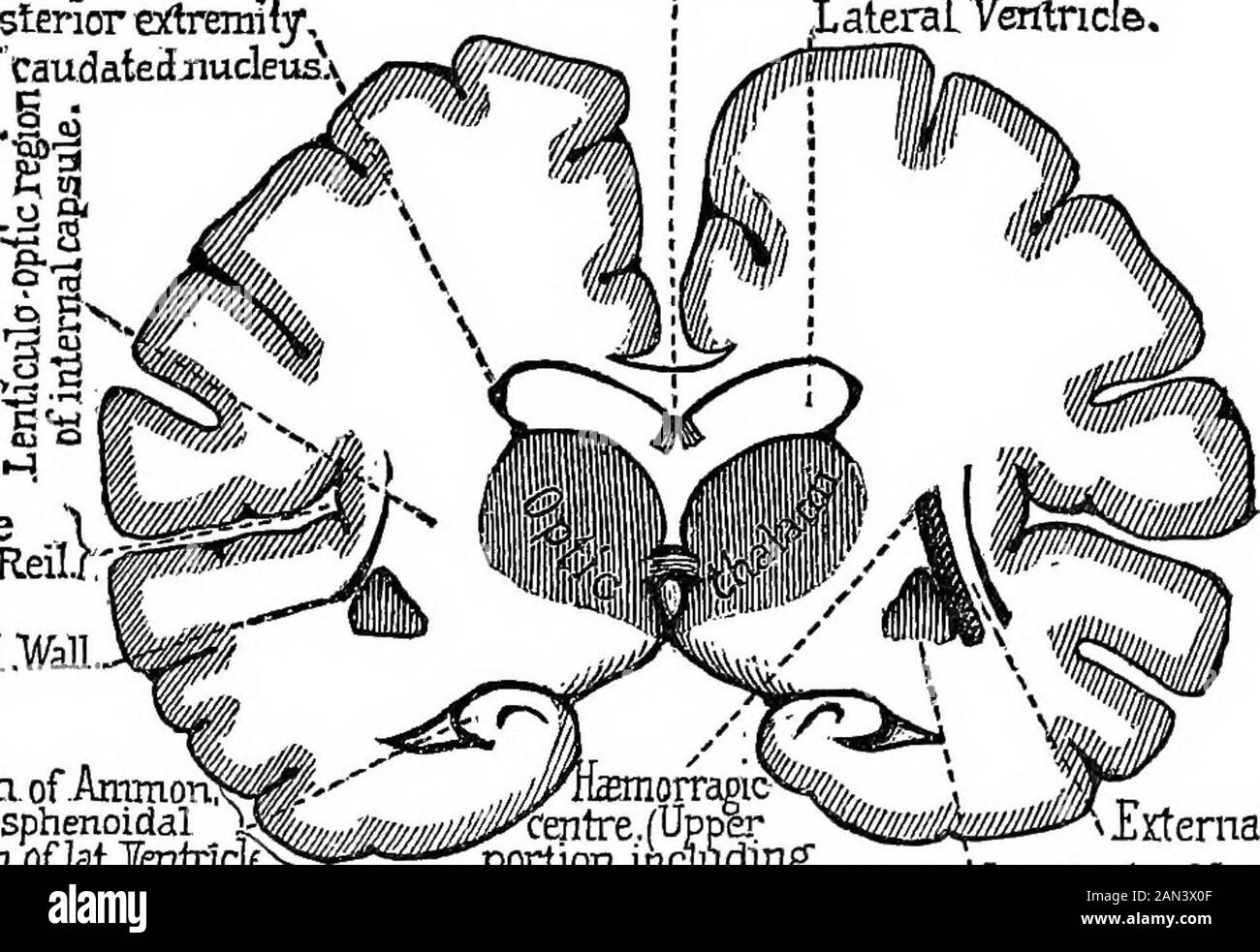 Des conférences sur la localisation des maladies du cerveau, données à la Faculté de médecine, Paris, 1875 . distinction.Nous avons déjà dit que les symptômes diffèrent en fonction de la portion de la capsule interne affectée par la lésion. Si elle occupe une partie des deux tiers antérieurs du thecapsule, la région où le tractus blanc sépare l'extrémité ante-rior du ganglion lenticulaire de la tête du ganglion théadaté, et qui appartiennent, comme vous le savez, au champ de l'artère létulo striée, h& paralysie sera ex-indice que le mouvement oi ; il n'y aura pas de tr durable Banque D'Images