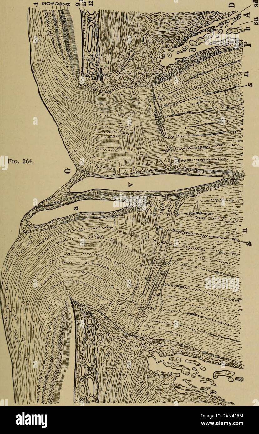 Texte-livre d'ophtalmologie . e sclera arc reflectedbackevers et forme la gaine de la durale, 1). Qui enveloppe le nerf sans serrer. Entre ces twosheats se trouve un tiers, la gaine arachnoïdienne, A, qui divise l'espace intervaginnl du nerf optique en l'espace sutidural, td, et l'espace subarachnoïdien, ainsi. Les deux extrémités sont antériorly par un cul-de-sac dans le SUbetanoe de la sclera l&gt; est la section cro&gt;s de l'un des nombreux trabeculeid sous-arachnoid qui relie l'arachnoid à la gaine piale. Dans le mur du canal scléral est vu la section transversale de certains vaisseaux sanguins, appartenant à Zinns s Banque D'Images