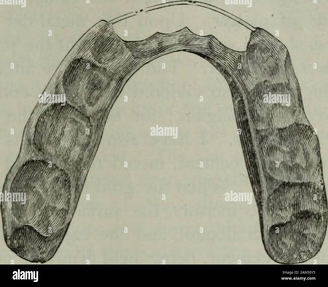 Le cosmos dentaire . ticable ce luminaire, quelque peu l'onu-confortable pendant la mastication, a été remplacé par une plaque inférieure, couvrir-ing les molaires, passant à travers les surfaces linguales des oralteeth et renforcé par un demi-tour sur le fil d'or platiné passant *à faire de moulages de plâtre de très longues dents, un morceau de bois d'hickory-orbamboo placés dans l'impression de la dent avant que le plâtre est coulé willprevent la rupture de la dent lorsqu'il est retiré de l'impression. Les dents à mouvement alternatif. Une étude. J053 sur les surfaces des dents incisives et cuspids. La partie supérieure de sur-f Banque D'Images