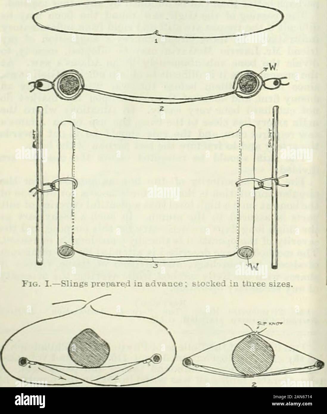 British medical journal . Fig. ni.-méthode alternative avec double couche de linge de maison, matériel ou de flanelle,calico. Pansements de gaze et vague sont quiteunsuitable. 6, Coffre-piD- l'étendue de l'élingue doit être dûment réglementés.pansements triangulaires peuvent également être obtenus. toujours L ?pecial élingues illustré dans la Fig. 1 (1, 2 et 3 ; exiger. préparation, et doit être rempli en trois tailles.Les tiges en bois (w) peut être façonné à partir de morceaux d'Goochsplinting, afin que tous les matériaux nécessaires sont easilyhad. Cassette, chaîne, forte et un solide coffre-pinscomplete l'arsenal thérapeutique. L'Ex Banque D'Images