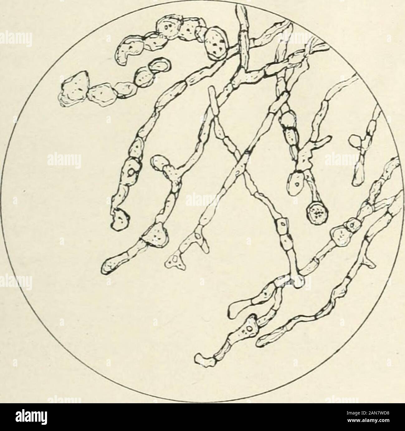 Le British Journal of Dermatology . appelé la-li-la-li ou tou ^^ très répandu dans les provinces, ofHopei Chakiang Anhoe Kiangsi,,. Il peut être dit dans une waythat il est très commun au sud du fleuve Yantse. EPIDERMOPHTTON RUBRUM. 123 J'ai mycologically a examiné six cas de la li tou succeededin giowing ; je les champignons de trois d'entre eux. À partir de deux AchorionSchoenleini isolé JE. Ils étaient donc les cas d'favns. À partir de l'thirdpatient J'Trichophyton violaceum isolées var. decalvans, Castellani.L'original la croissance sur gélose glucose était très lente, avec humidsurface et d'une couleur violette. L Banque D'Images