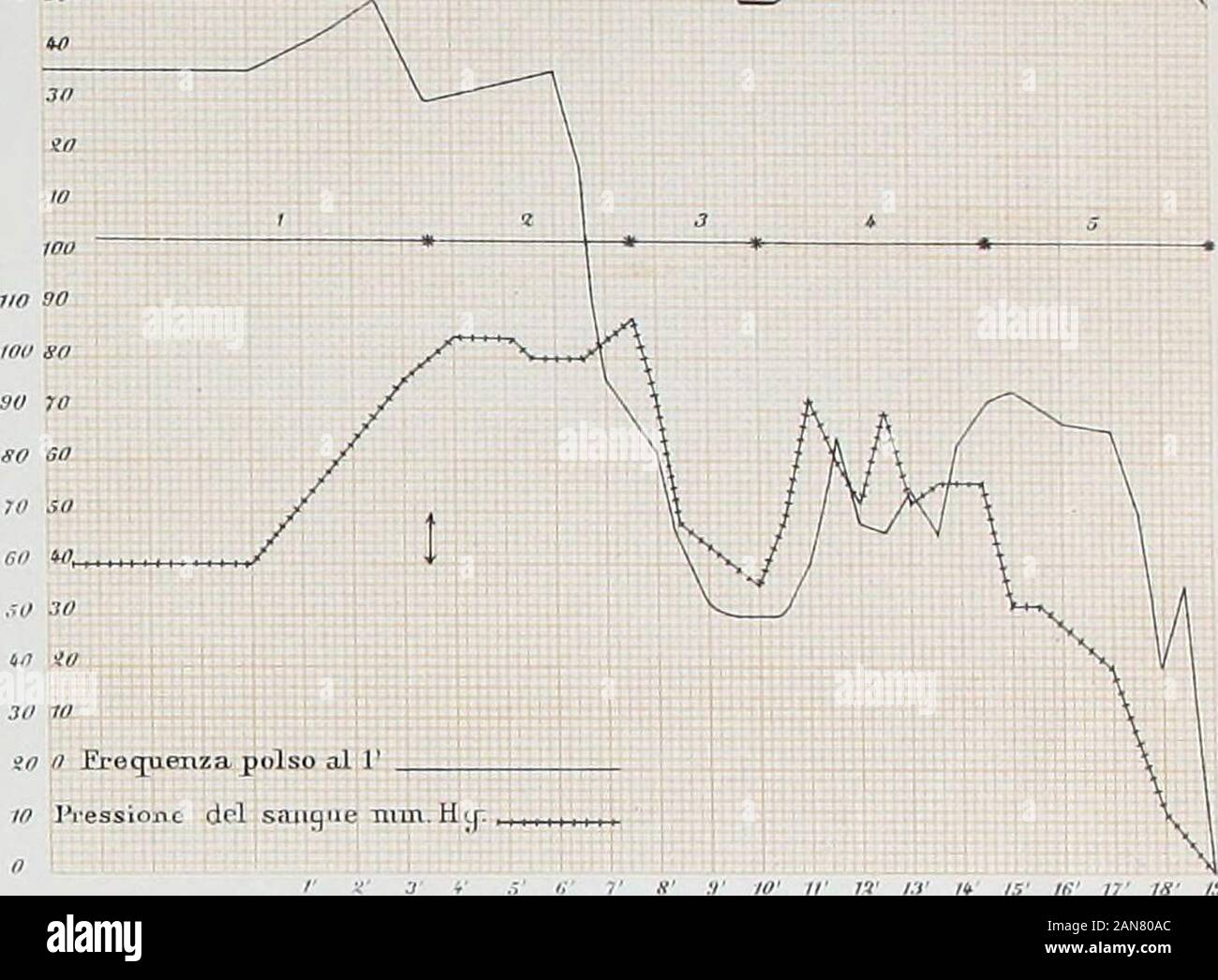 Memorie della Reale Accademia delle Scienze di Torino . t al Polso 1 . Frequenza polso ;. Pressione. sanguicpii Frequenza respirò Fitr. 5 777 77 72 7,7 7fr 75 10 Pois sg &gt ; si l'ioo y 90 f de sorte pr e s s 70 60 30 10 W, E/S ìel Resistenza e cuor ali I I Monili ec dell asfissia doli inizio io n- 11 73 /* ts te- IO IV W 13 /*- 15 16 17 18- 13 30 dans respiro Frequenza est Y   a a. Pour l'ONU 30 30 10 -io io o .Frequenza polso al V dans Pressione 145 tutti Hcr. o Minuti dal principio dellesperienza r io n ir 13- / + TS- 16 16 17 18 Schema Koiunv Stenbechsnllandanienio di e della frequenza del polso e Banque D'Images