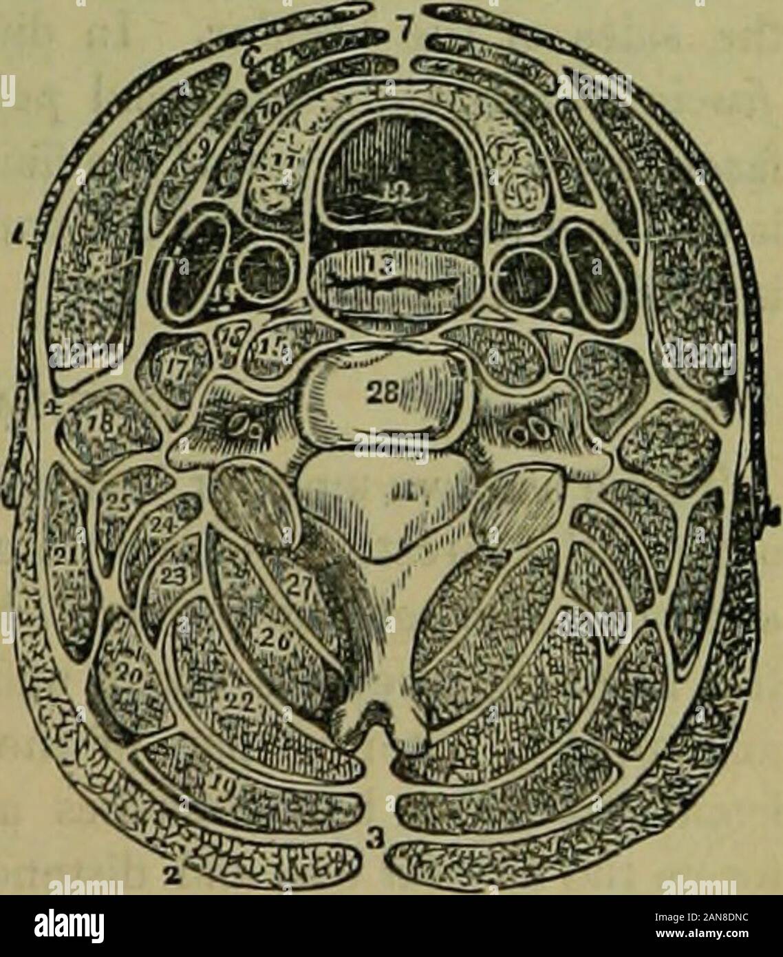 L'établissement thermal encyclopédie : un système d'hygiène et de l'hydropathie .. Chanter l'othermuscles . cf le cou. 4. Division de l'fasciato forme une gaine pour le sterno-mastoïdien mus-cle (5). 6. Point de la réunion. 7. Union européenne de l'aponévrose profonde de chaque côté du cou.B. L'article de la sterno-arc hyoïdien. 9. Omo-hy-oid. 10. Sterno-thyroïdien. 11. Lobes latéraux de la glande thyroïde. 12. La trachée. 13. ./Eso-phagus 14. La gaine contenant des commoncarotid internni, artère jugulaire, andpneuniogastric nerf. 15. Longus colli ; dans ironr thelympathctic est nerveuse. 16, Rec-tus auticus major. 17. Scalenus anticus. Est.Scal Banque D'Images