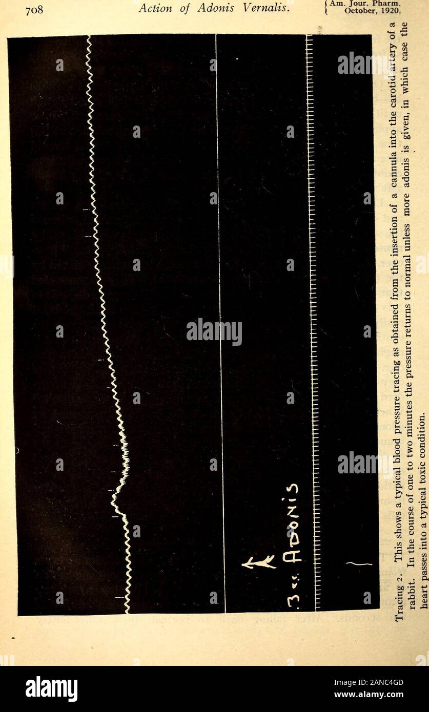 American journal of pharmacy . n de 0,5 milligramme. ofdigitoxin par kilo, tandis qu'adonis 65 mg. par kilo, ou l'un hun-dred et trente fois plus grand une dose pour produire le même résultat.Si le manque relatif d'byadonis possédaient des propriétés émétiques est dû au fait qu'il est non-irritant pour les muqueuses mem-branes, ou qu'il est incapable de produire l'émèse en agissant sur themedulla, le simple fait qu'il n'a pas la même quantité d'action comme ofemetic la digitaline pourrait être un précieux facteur thérapeutique, forpatients souffrant de décompensation cardiaque peuvent souffrir de symptômes gastriques, severelyfrom Banque D'Images