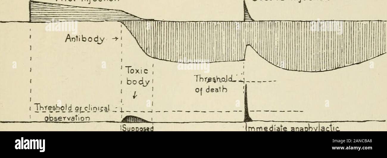 Archives de médecine interne . est indiqué en abscisse. L'anticorps est indiquéespar des voyants d'ombrages verticale au-dessous de l'abscisse et l'antigène (ou allergène) est C. E. VON PIRQUET 411 illustré par des ombres horizontales au-dessus. Par cet antigène (terme Detres)1 comprendre une substance qui est capable de donner naissance à un anticorps dans theorganism. La figure 2 montre dans une manière très schématique la formation ofprecipitin in rabbits. Le premier jour une quantité considérable de l'antisérum est injecté. Ce cheval-sérum ne disparaît pas immédiatement.Sa présence peut être démontré par un test quotidien avec antihorse anothera-sérum de Banque D'Images