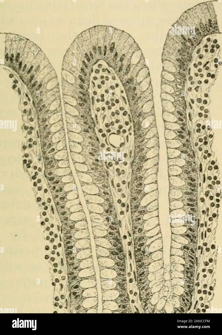 L'anatomie humaine, y compris la structure et le développement et des considérations pratiques . MuscleSerous coat longitudinal section longitudinale du côlon ascendant, général arrangemetit montrant de couches et solitaire, nodule lymphatique. X 30. Le lyynphatic dans les tissus des collections des nodules solitaire,Peyers uniquement en l'absence de correctifs dans le gros intestin. Les nodules lymphatiques-whichoccupy, une partie de la couche sous-muqueux ainsi que la muqueuse, sont plus gros et plus IXTPLSTINE LA GRANDE. 1659 nombreux dans le cæcum, et en particulier dans l'appendice vermiforme, dans lequel sont si nombreux qu'thenodules Banque D'Images