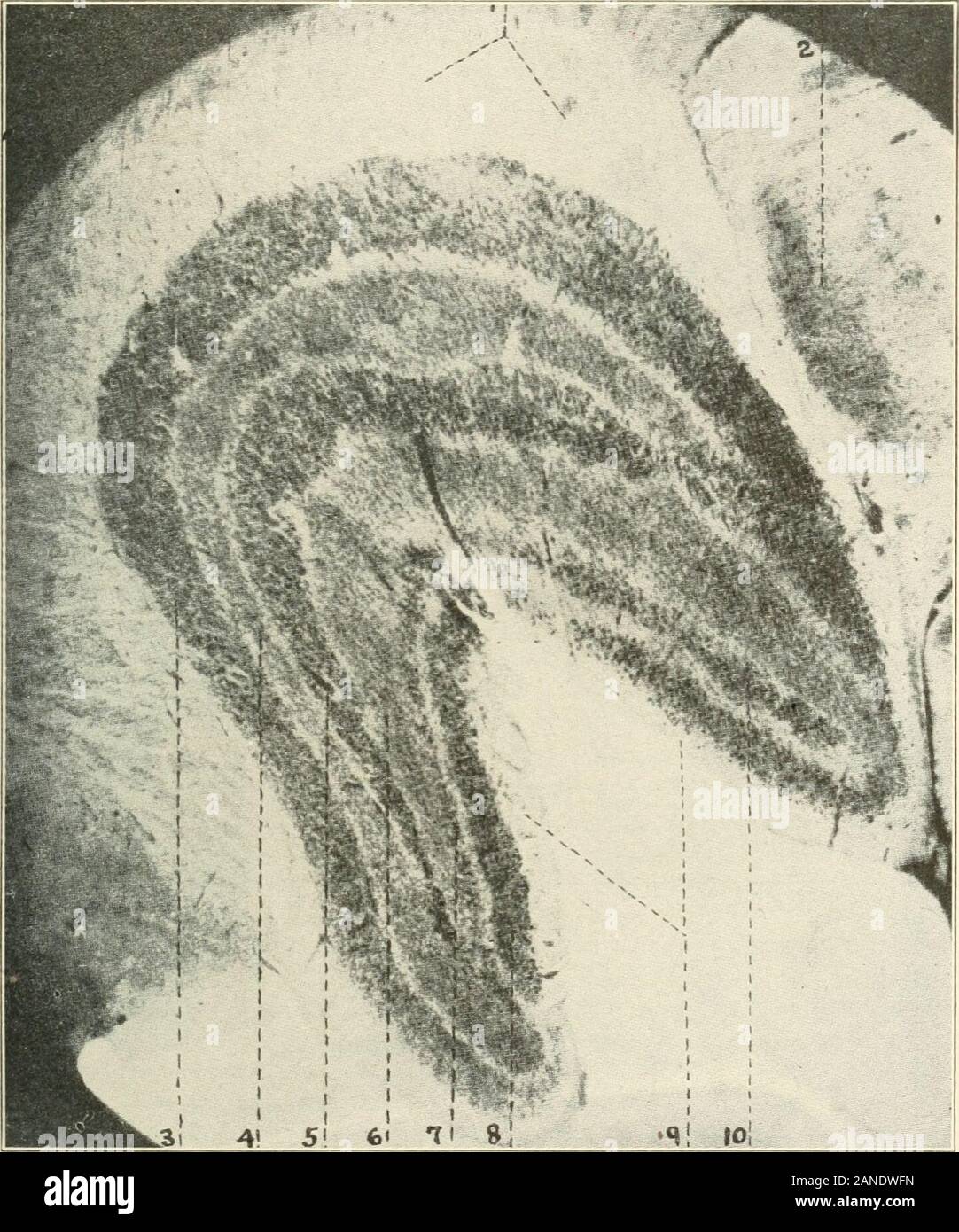 AMAarchives de neurologie et psychiatrie . avec par l'auteur. Dans l'homme et le singe, il y a un accessoire externe noyau de l'genicu-fin de la DBO, le gresium praegcniculatum. qui a été décrite comme une partie de la zone réticulaire et le thalamus. À partir d'une étude de la dégénérescence secondaire, theauthor ce noyau classes parmi les principaux centres visuels. Le gresiumpraegeniculatum commence un peu en avant de la partie antérieure du corps genouillé externe dans le corps de l'angle dorsolatérales voies optiques. Son internalportion" passe à la région sous-thalamique et se trouve à côté de la face ventrale de l'nucleusof Banque D'Images