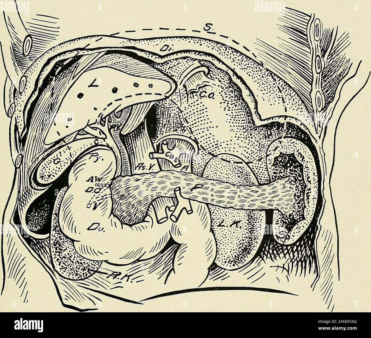 Un texte-livre d'anatomie clinique : pour les étudiants et les praticiens . même tocount, les bords libres des deux dernières côtes afin de déterminer si l'thetwelfth est absente, en raison du danger de l'ouverture de la cavité pleurale. De cette manière le pôle supérieur du rein droit, ainsi qu'thesuprarenal capsule, qui se trouve à ce point, est près de la com-sinus complémentaire de la plèvre. Par conséquent, les abcès du rein s'mayperforate dans la cavité pleurale et provoquer un empyème. On entoura les deux reins sont dans une capsule fibreuse, ce qui est mince, andmay être facilement enlevé le parenchyme. Il a Banque D'Images