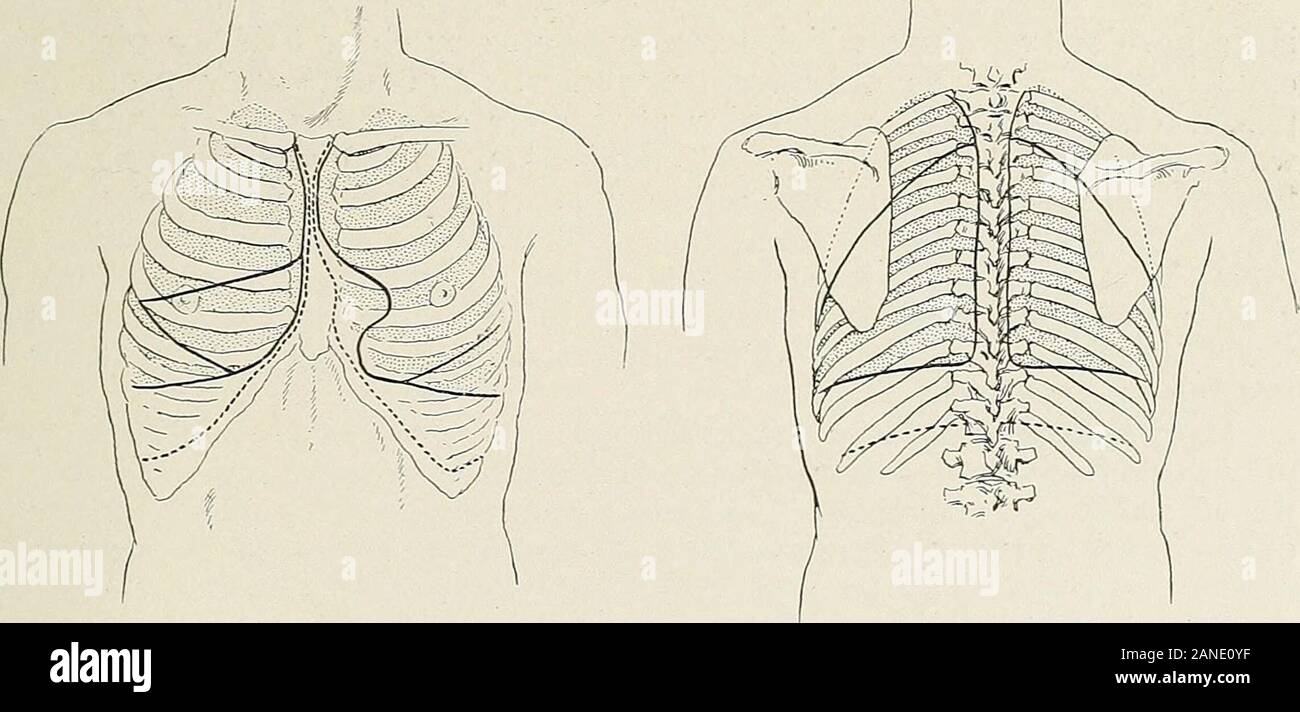 Les maladies de la poitrine et les principes de diagnostic physique . Fig. 352.-l'empyème sont encapsulés à Fig. 3.53.-diagramme de base section sagittale du poumon gauche. Section sagittale du thorax au milieu de la clavicule gauche, milieu d'indicatingthrough clavicule gauche. {, Ashhurst - site sur lequel a été trouvée à l'autopsie de pus.cliniques internationales, vol. iv, 26e série.) (Ashhurst, les cliniques internationales, vol. iv, 26e série.). Fig. 354.-Anteriorviewof fissures de poumons Fig. 355.-vue postérieure des fissures de lignes pointillées indiquent la plèvre. les poumons. Les lignes en pointillé indiquent la limite inférieure des sacs pleural. 602 DISEA Banque D'Images