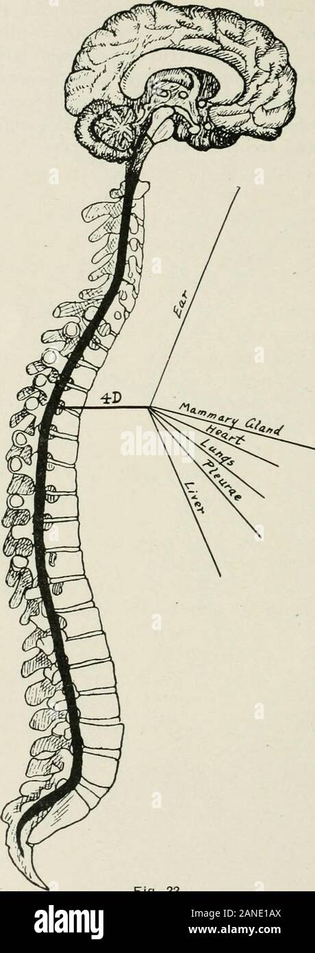 Principes et pratique de l'ajustement de la moelle épinière ; à l'usage des étudiants et des praticiens . Fig. 21. ThirdDorsal pièces influencées par le nerf. CRANIUM, LE VISAGE ET LE COU 133 société l'artère thyroïdienne inférieure à la glande thyroïde.Ils communiquent sur l'artère avec les nerfs cardiaques, etdans le gland avec les nerfs laryngés récurrents et externes.3. Les septième et huitième nerfs aussi influencethe thyroïde, depuis leur adhésion à l'ganglionwhich cervical inférieur envoie aux fibres, ganglion cervical moyen et avec le débit cardiaque et les nerfs laryngés récurrents. 134 AJUSTEMENT DE LA MOELLE ÉPINIÈRE. Fig. 22. Pa Banque D'Images Principes et pratique de l'ajustement de la moelle épinière ; à l'usage des étudiants et des praticiens . Fig. 21. ThirdDorsal pièces influencées par le nerf. CRANIUM, LE VISAGE ET LE COU 133 société l'artère thyroïdienne inférieure à la glande thyroïde.Ils communiquent sur l'artère avec les nerfs cardiaques, etdans le gland avec les nerfs laryngés récurrents et externes.3. Les septième et huitième nerfs aussi influencethe thyroïde, depuis leur adhésion à l'ganglionwhich cervical inférieur envoie aux fibres, ganglion cervical moyen et avec le débit cardiaque et les nerfs laryngés récurrents. 134 AJUSTEMENT DE LA MOELLE ÉPINIÈRE. Fig. 22. Pa Banque D'Images