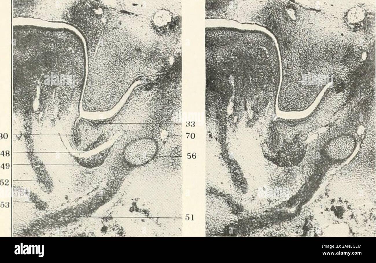 Contributions à l'anatomie et le développement des glandes salivaires dans la mammalia . FIG. 149. FIG. 152. LXXXHI la plaque de figues. 153-156. Articles de la région d'un alveolingual 14 millimètres, embn-o.Colombie-Britannique Collection. Xo. 122. montrant un stade précoce de l'ebauche de l'sublingualis major. Les sections de série X, 115, réduit à 5. JO. Submaxillar)- anlage. jj. Une plus grande sublingual anlage. 48. Ner multilingue-e. 4Q. SubmaxUlan-, ganglion. 5/. Muscle Mylohyoid 52. Genioglossus muscle. jj. Le géniohyoïdien muscle. y6. Meckels le cartilage. 70. Nerf dentaire inférieur. LXXXIII. plaque. FIG. 153. FIG. 155. Banque D'Images