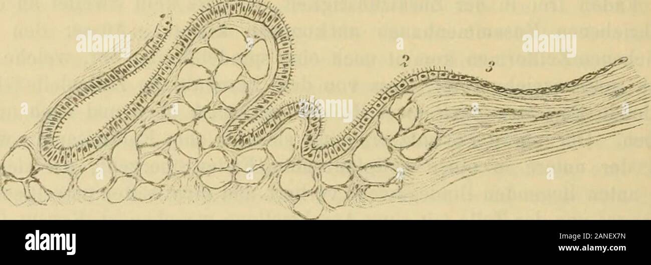 . Hörganges Ohrenheilkunde Handbuch der, Trommelfells u. Mittelohres. Unterlage sind dans neuerer Zeit mehrere Arbeiten erschienen. Hier habenwir vorzugsweise diejenigen, welche im Auge über das han-Darmepithel deln, und Stimmen dieselben dans tiberein erfreulicher Weise mit dem, wasVerfasser schon in einer früheren Arbeit (Kessel, 60) dargethan hat.Er konnte den Nachweis nämlich die Herstellung, Cylinderepithelien beiPolypen Entzündungsprodukte, wo dieselben einander die aus ihren, gedrängtwerden adenoiden mit dem Gewebe resp. vasculären Lymphräumen péri-Lymphgefässen und deutlich Banque D'Images