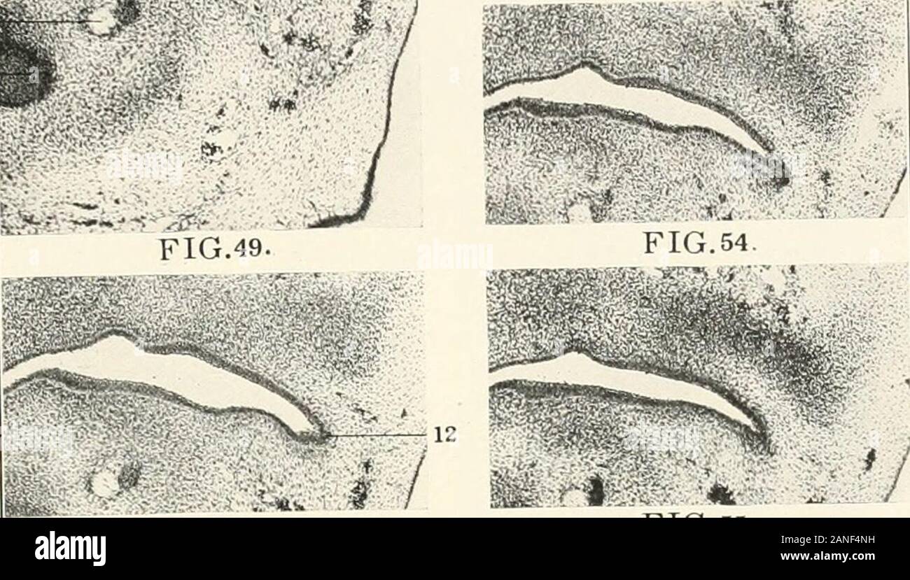 Contributions à l'anatomie et le développement des glandes salivaires dans la mammalia . ra-.f-^^r-----.  ? ? ? ? Dans• ? ? ? ? FIG.53. Banque D'Images