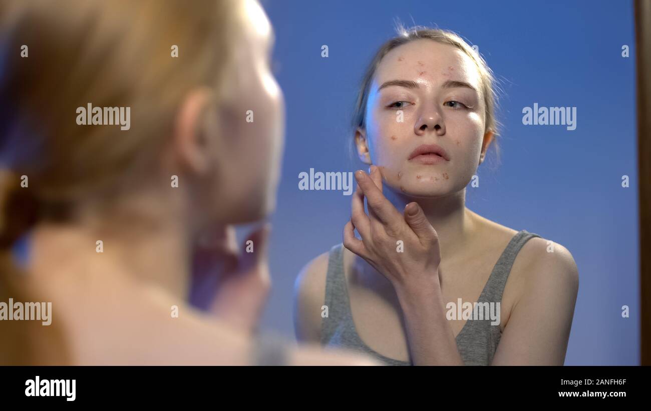 Man en miroir et l'application de la crème pour le visage, soins de la peau traitement de l'acné Banque D'Images