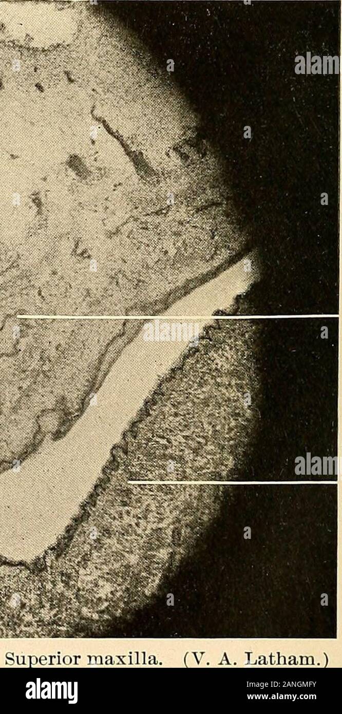 Principes et pratique de la dentisterie opératoire . Fig. 121.-section verticale de l'incisive, emb :. Secondaryepithelial frorthe Langue muqueuses directement maxillaire. (V. A. Latham.) X 50. L'émail cordon épithéliale primaire-ou-gan, per-manent toothEnamel-ou-gan, decidu-ous tooth Banque D'Images