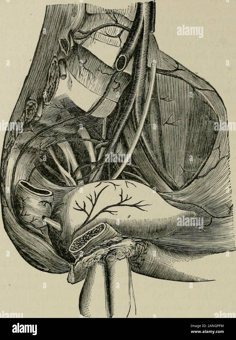 L'Encyclopédie internationale de chirurgie, un traité systématique sur la théorie et la pratique de la chirurgie . la source précise de l'hémorragie n'a pas été déterminée. Il a été décidé que même notalways les vaisseaux hémorragiques ont été l'intermédiaire de succursales ou de l'iliaque interne. Dans aucune région, aussi, était l'application de la règle d'un navire ligature des blessés au-dessus et au-dessous de l'lesionmore difficile, et dans aucun furent les conséquences de négliger ce rulemore^ désastreux. plaies de l'artère iliaque interne.-l'lésions primaires d'thisvessel, comme celles de l'artère iliaque commune, mais sel Banque D'Images