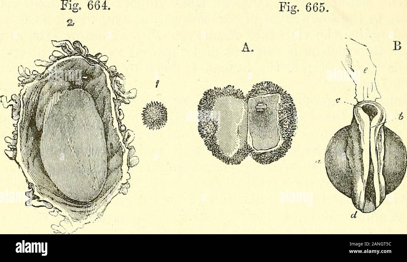 Éléments d'anatomie du Quain . 772 Les droits de l'UTEEOGESTATIOJSr yLth. ou d'un pouce. Pas de traces étaient n'importe où pour être détecté de anembryo ; mais la membrane de l'Avhich villositiessprang ovnm à partir de l'est de la structure cellulaire, et au milieu de la partie lisse,tourné vers l'utérus, il y avait un point opaque qui pourrait betaken pour l'embryon d'un salon, et qui a présenté à l'interne un thinlayer de cellules nucléées finement granulaire. L'ovmn jeter sur l'intérieur de la face postérieure de l'utérus près du bord supérieur, intégrés dans la muqueuse épaissie ou deciclua, et d'avoir une fine couvrant Banque D'Images