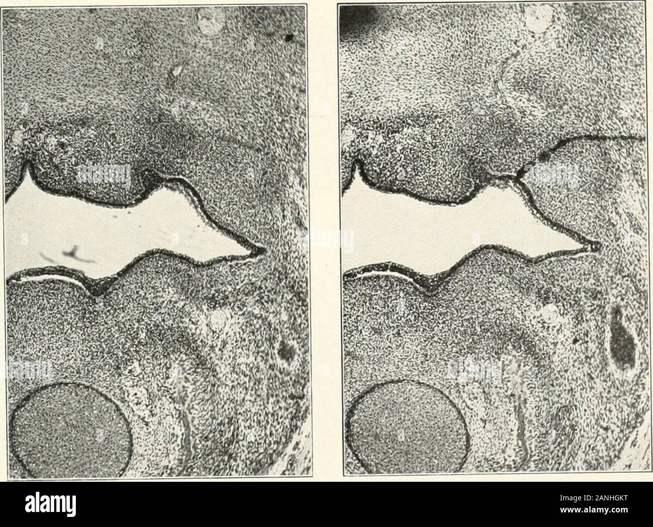 Contributions à l'anatomie et le développement des glandes salivaires dans la mammalia . Fig. 8. Fig. 0-. Fig. io. Fig. II. Platk XV Fig. 13. Série 335. diapo 17. tx&gt;v 1. seclioii .. N-duicd... X . Fig. 1 j. Série 335- diapositive 16. rang 4, section 8, X 80, J. reducetl 2. Anlaso parotide. 5. Propaailid crest. g. Sulimaxillary anUige. 10.-suMiiigual aiilagc tJa aler. / ;. Aiilage apiial de glande. J. Poslglaiidular flatigc j. 31. Meckels j.y. le cartilage. SuiKrior aiilage déni. 29. Déni inférieure anlage. JO. Nerf lingual. J J. Ilyiwglossal nerf. jj. Ihiccal aerw. J4. Kilaline Fclo|sulcus. PLATE Banque D'Images