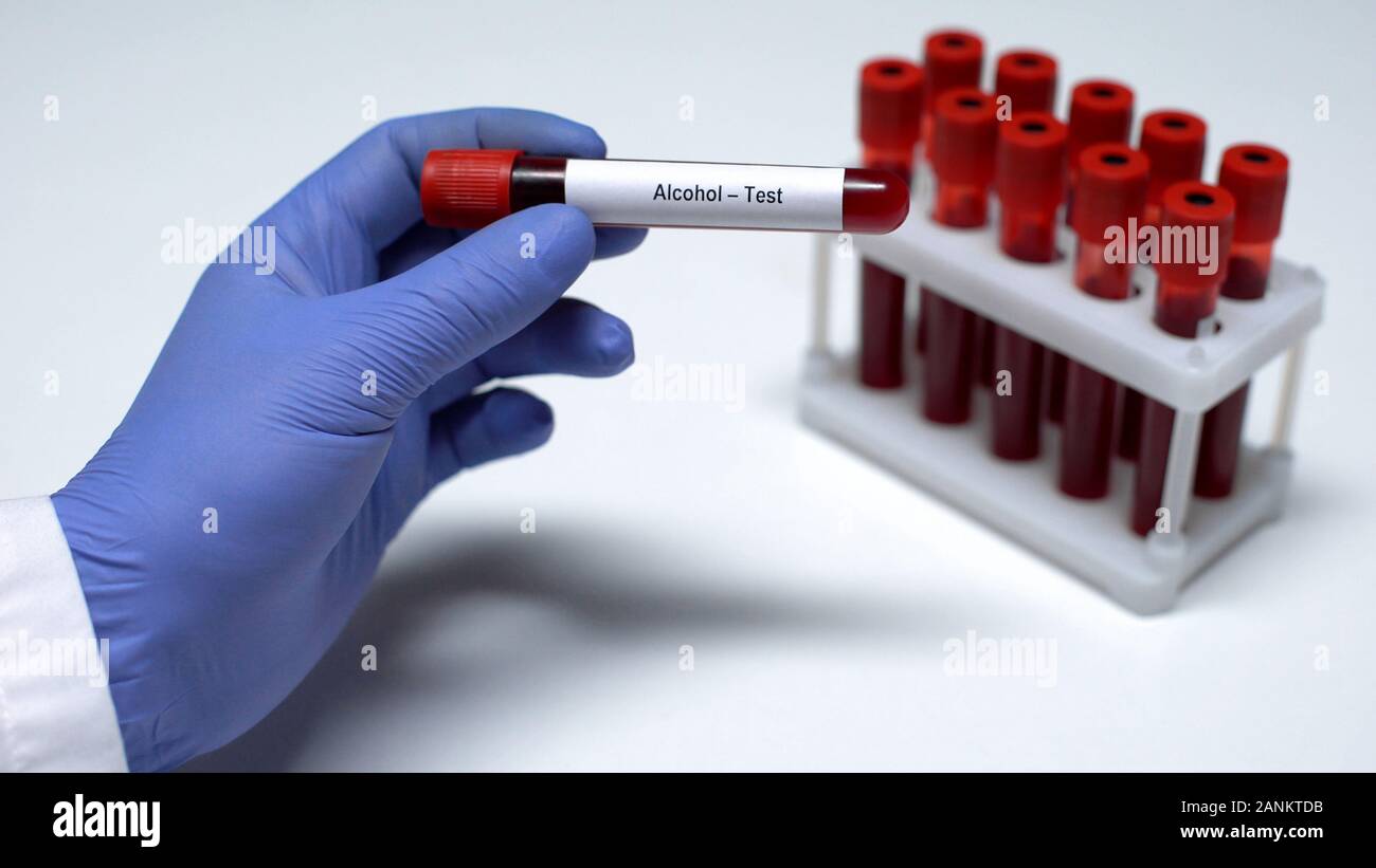 Test d'alcool, médecin montrant échantillon de sang dans le tube, lab  recherche Bilan de santé Photo Stock - Alamy