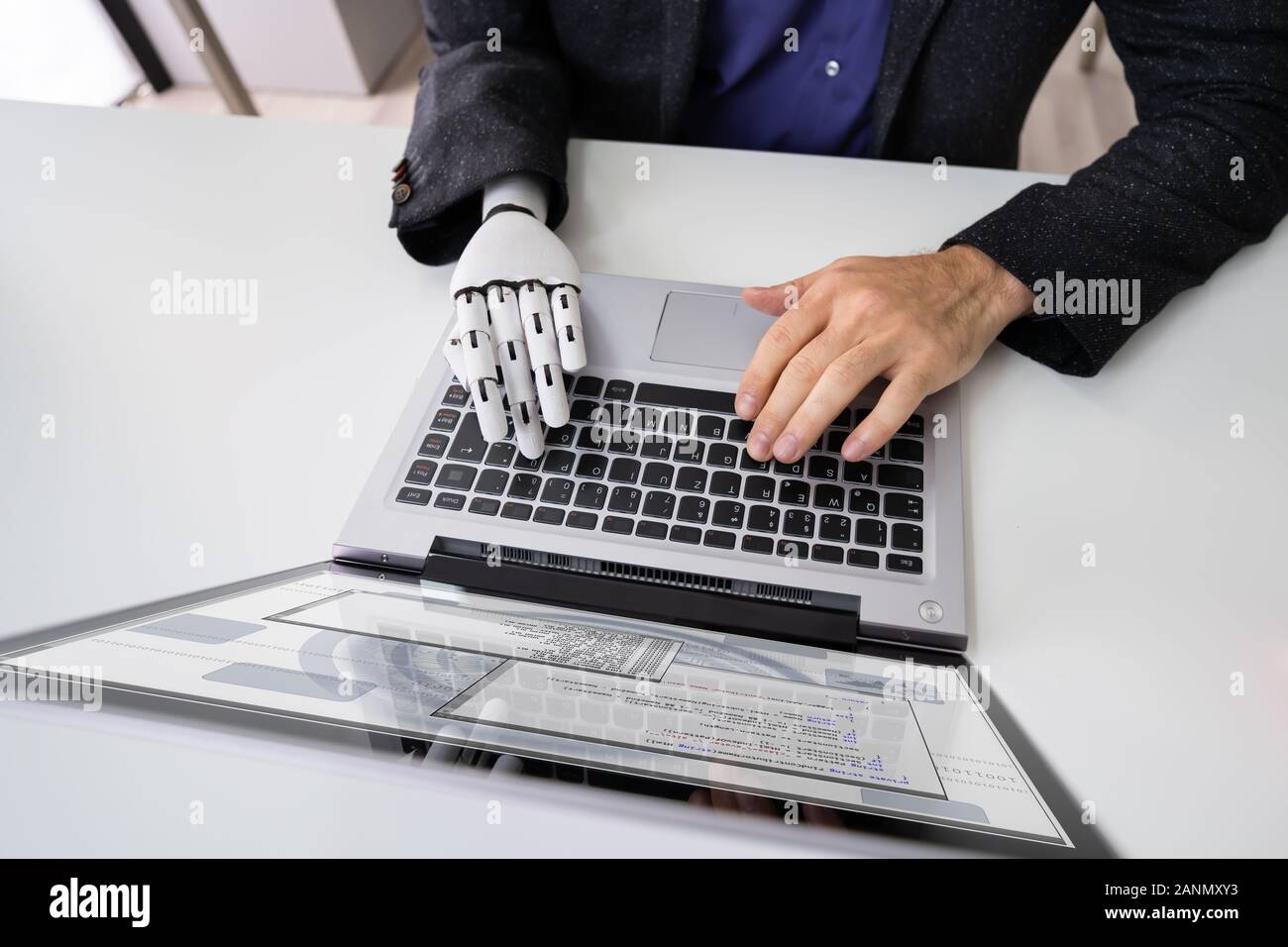 Homme avec prothèse de main travaillant sur ordinateur portable. Membre artificiel Banque D'Images