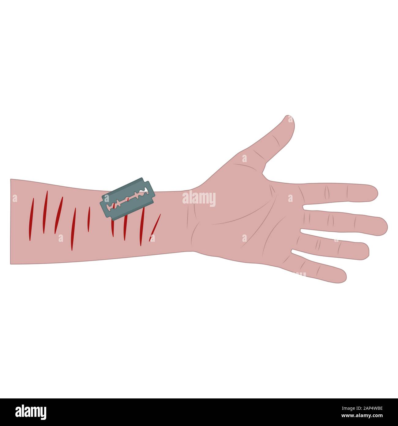 La main de l'homme blanc avec saignement coupures et une lame. Tentative de suicide. fond blanc stock isolé vector illustration Illustration de Vecteur