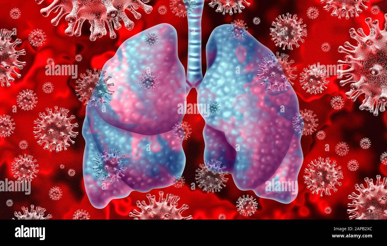 Le virus respiratoire et l'éclosion de coronavirus et le coronavirus utilisent le contexte de la grippe comme cas dangereux de grippe ou le SRAS comme pandémique médicale. Banque D'Images