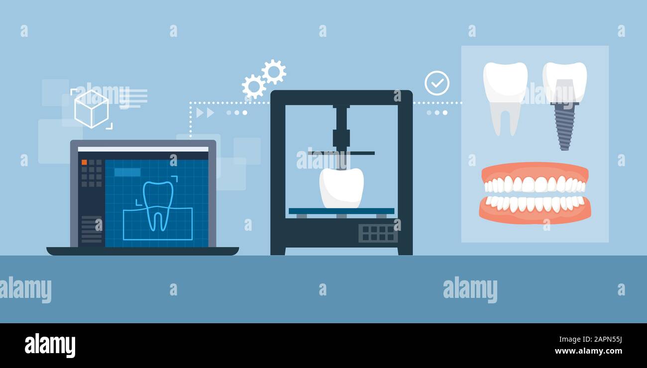 Processus d'impression médicale en trois dimensions de prothèses et d'implants dentaires : modélisation en trois dimensions avec logiciels, produits d'impression et produits finaux Illustration de Vecteur