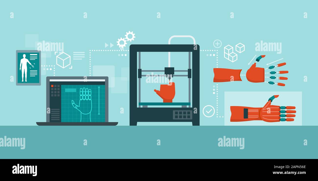 Processus d'impression médicale d'une main prothétique : modélisation tridimensionnelle, impression, assemblage et produit final Illustration de Vecteur