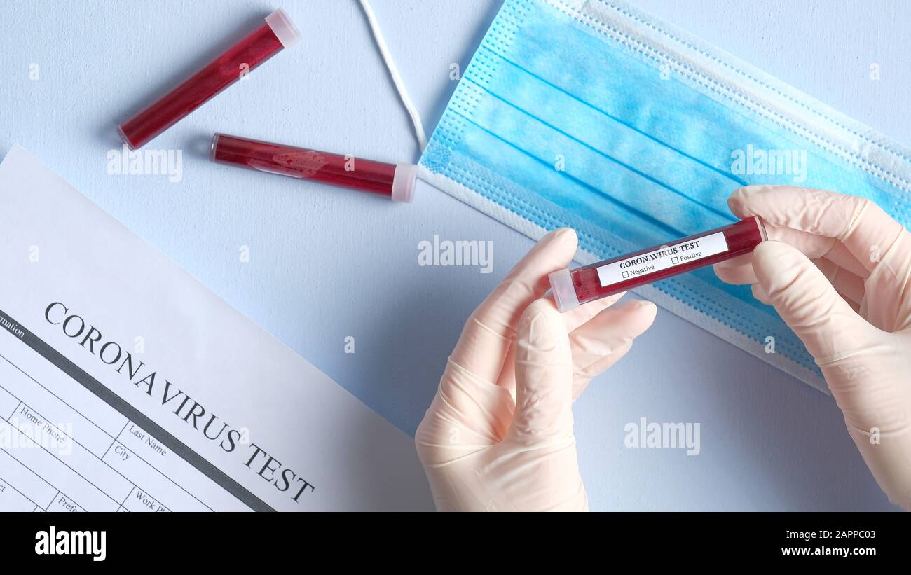 Concept de test sanguin du coronavirus. Le médecin a les mains dans des gants médicaux portant un tube à essai avec du sang pour l'analyse du coronavirus sur un bureau de laboratoire. 2019-nCoV C Banque D'Images