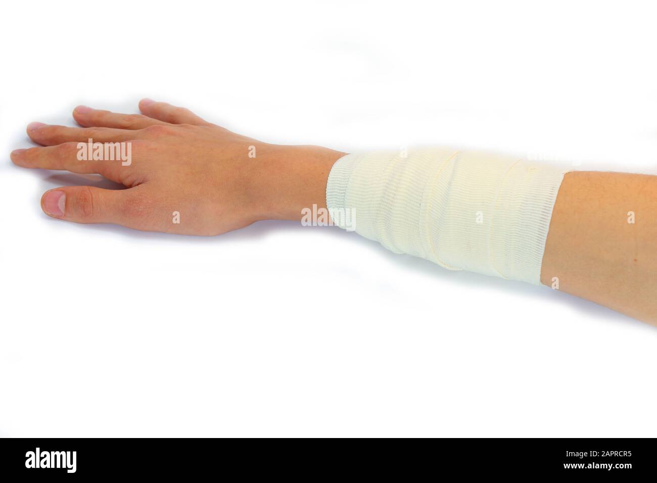 le bandage du bras d'un garçon après la brûlure de l'avant-bras sur fond  blanc Photo Stock - Alamy