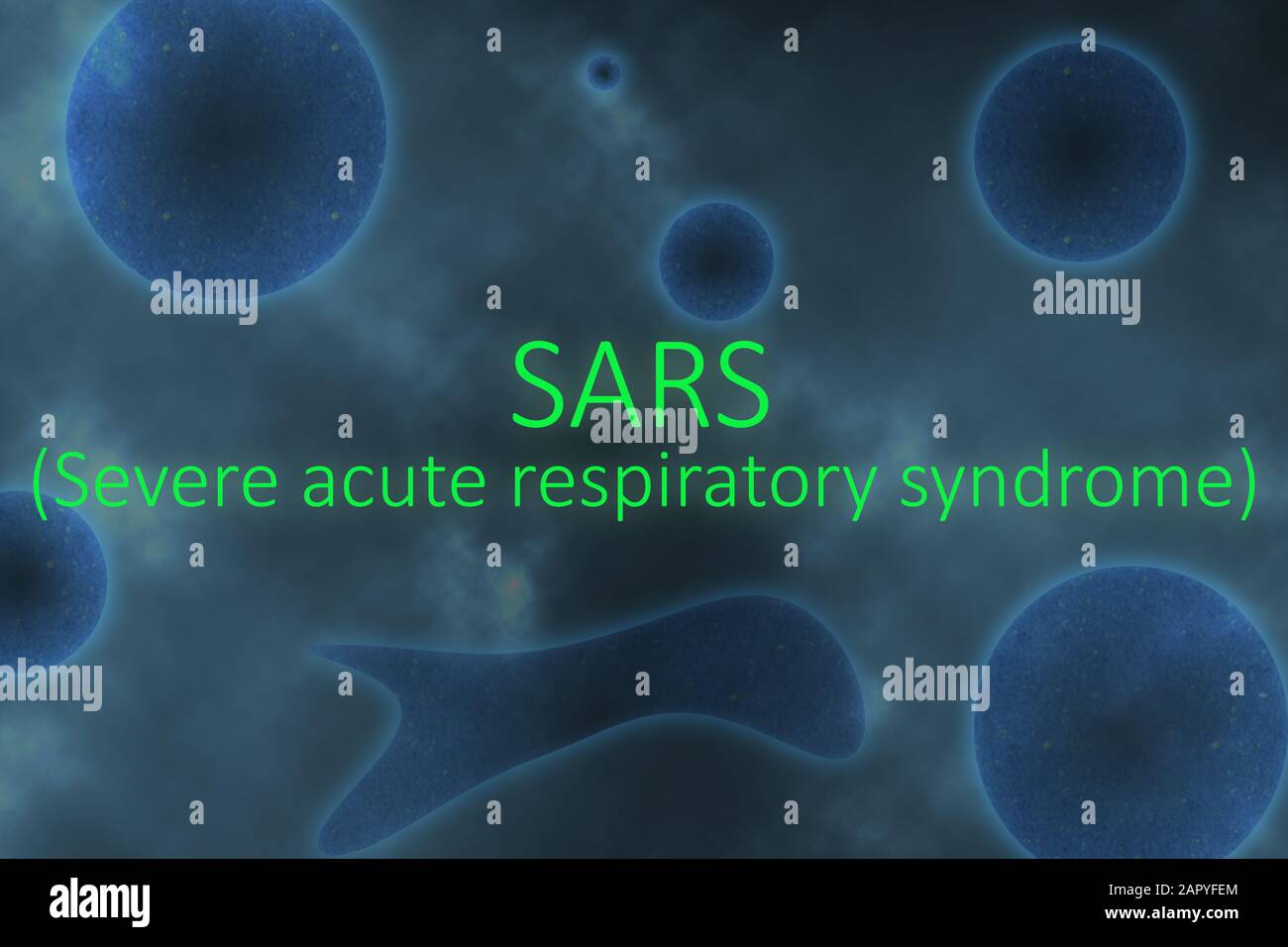 Exemple de SRAS ou de coronavirus Grave du syndrome respiratoire aigu sur un virus et cellulaire comme un fond bleu. Banque D'Images