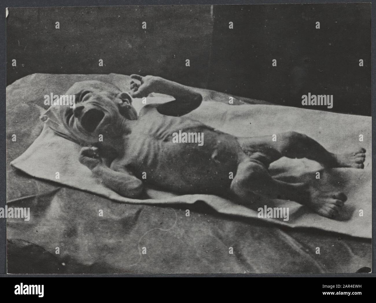 Faim hiver 1944/1945 faim hiver, bébé de quatre mois souffrant de malnutrition Date : 1 janvier 1945 lieu : Breda, Noord-Brabant mots clés : bébés, faim, enfants, malnutrition Banque D'Images