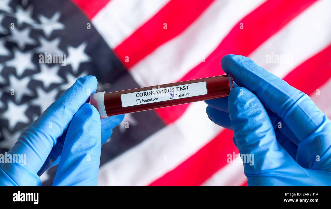 Concept d'éclosion de coronavirus aux États-Unis. Une infirmière a la main dans des gants portant un tube à essai avec du sang infecté sur le drapeau des États-Unis d'Amérique. Test sanguin Banque D'Images