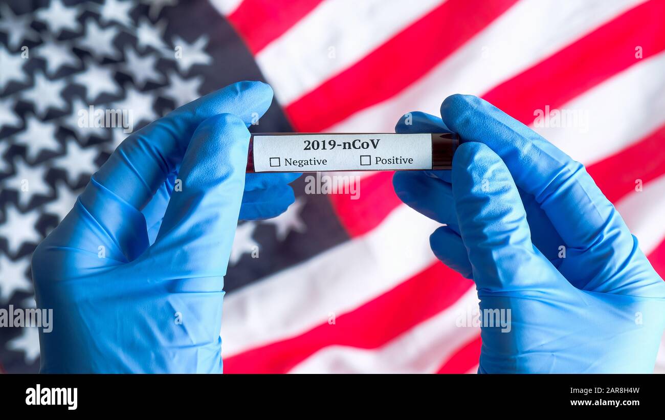 Concept d'éclosion de coronavirus aux États-Unis. Mains d'infirmière tenant le tube à essai avec du sang au-dessus du drapeau des États-Unis d'Amérique. Test sanguin pour 2019-nCoV Nove Banque D'Images