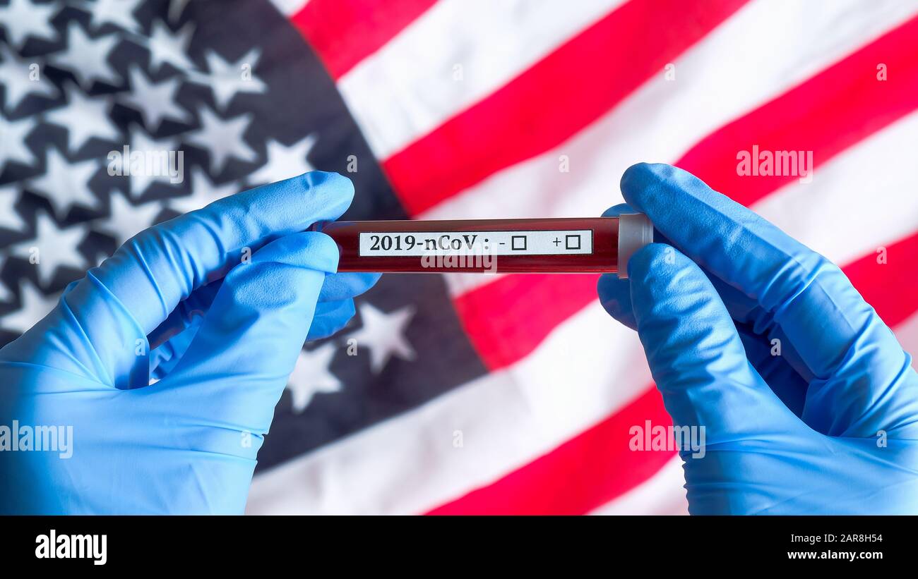 Concept d'éclosion de coronavirus aux États-Unis. Mains d'infirmière tenant le tube à essai avec du sang au-dessus du drapeau des États-Unis d'Amérique. Test sanguin pour 2019-nCoV Nove Banque D'Images