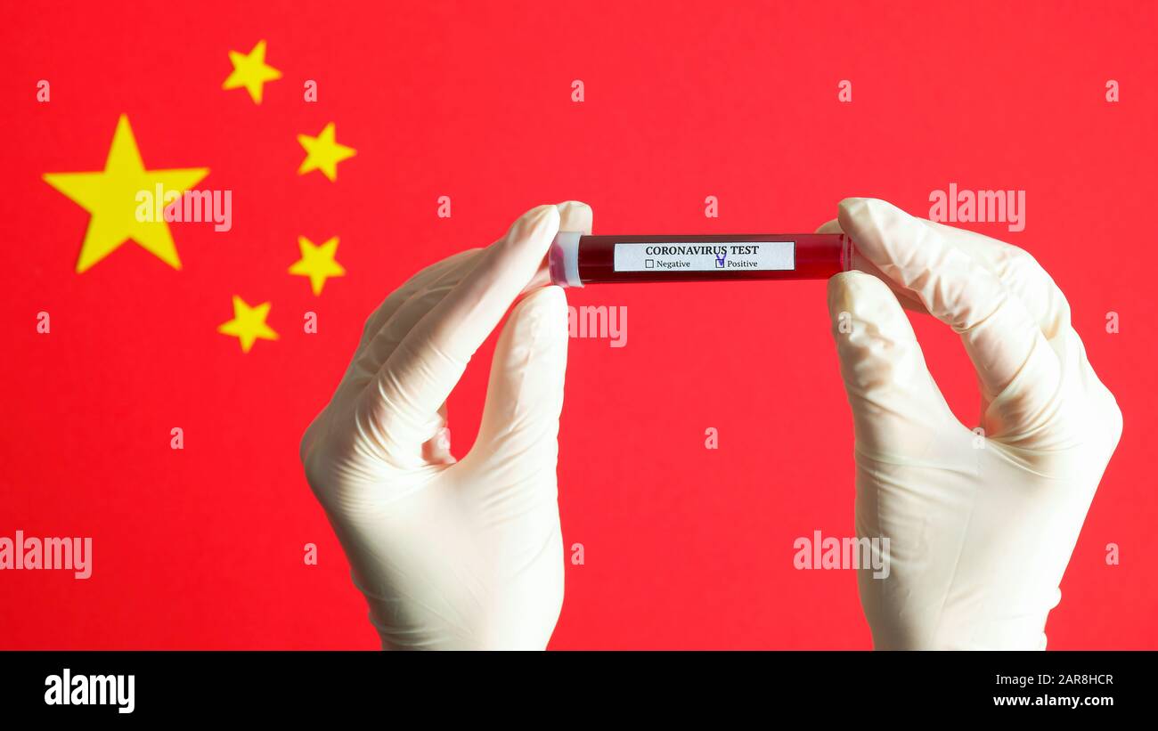 Mains d'infirmière dans des gants portant un tube à essai avec du sang infecté par le coronavirus sur le drapeau de la Chine. 2019-nCoV Novel Chinois Coronavirus test de sang concept. À Banque D'Images