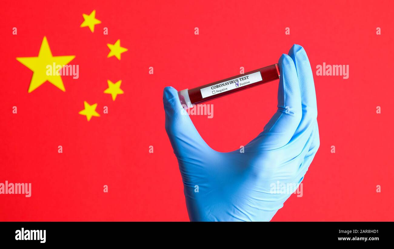 Main d'infirmière dans le gant tenant le tube à essai avec Coronavirus a infecté du sang sur le drapeau de la Chine. Nouveau concept de test sanguin du coronavirus chinois. Grippe 2019-nCoV Banque D'Images
