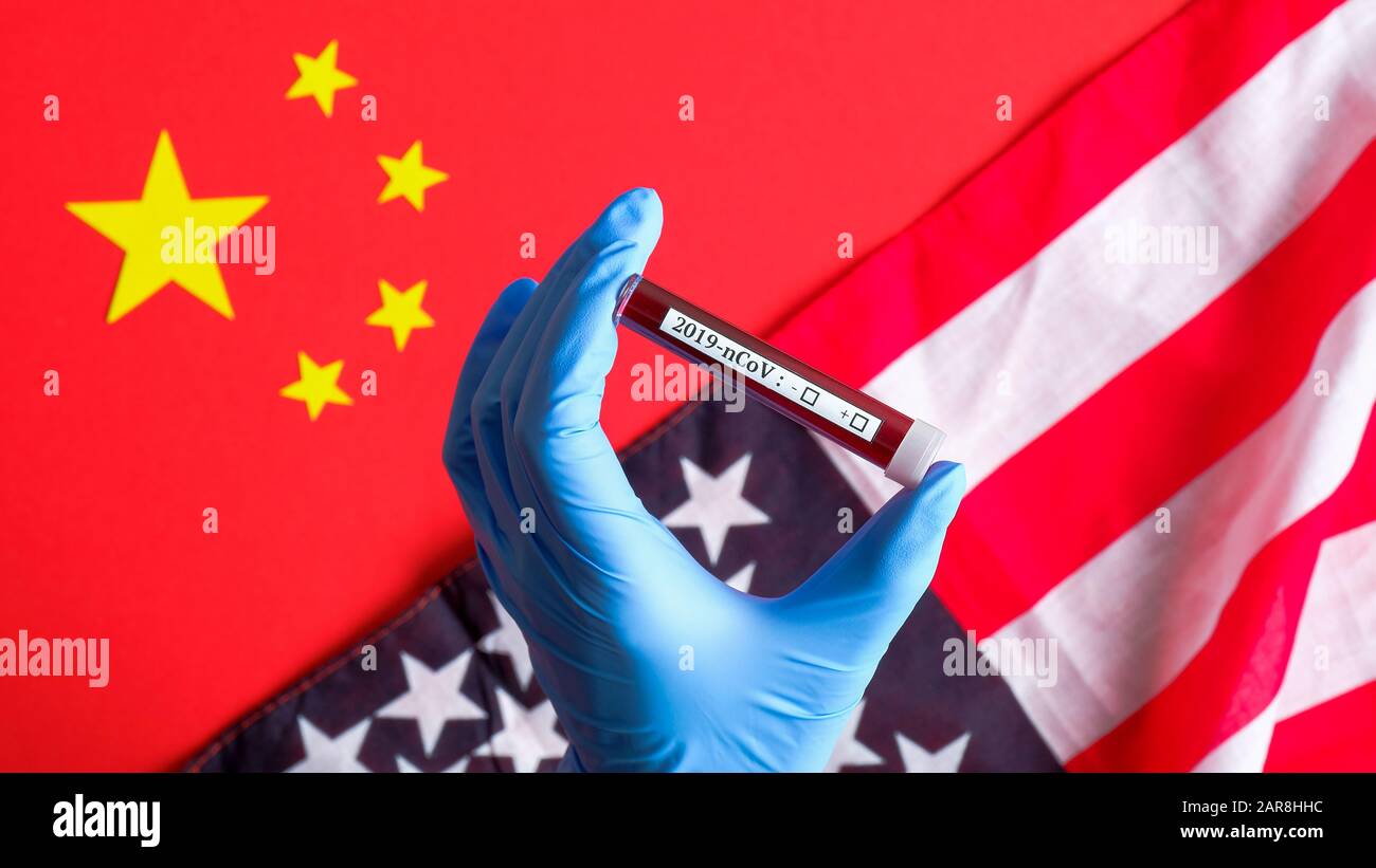 Tube de test de maintien de la main d'infirmière avec résultats de test sanguin de Coronavirus. Tube à essai avec du sang infecté par le virus Wuhan 2019-nCoV sur les drapeaux de la Chine et des États-Unis. Grippe Banque D'Images