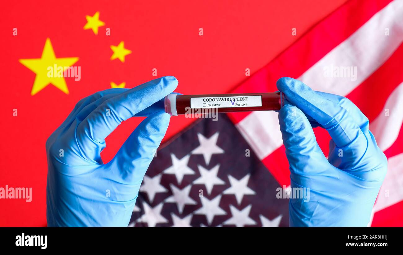 Tubulure d'essai avec test sanguin de Coronavirus. Tube à essai avec du sang infecté par le virus Wuhan 2019-nCoV sur les drapeaux de la Chine et des États-Unis. Fl Banque D'Images