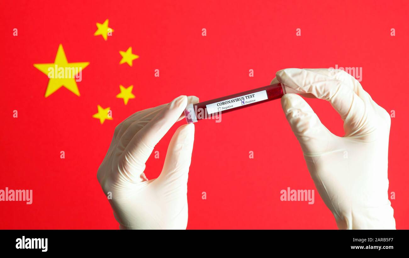 Nouveau concept de coronavirus 2019-nCoV. Mains d'infirmière tenant le tube de test sanguin avec résultat positif de test de coronavirus sur le drapeau chinois. Wuhan coronavirus ou Banque D'Images