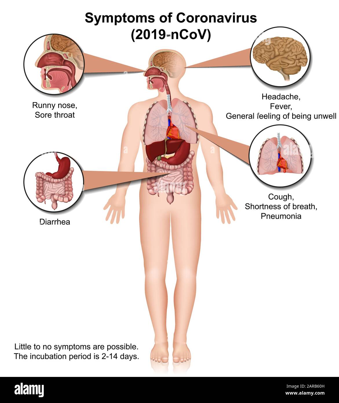 Coronavirus médico vectoriel infographie, symptômes Illustration de Vecteur