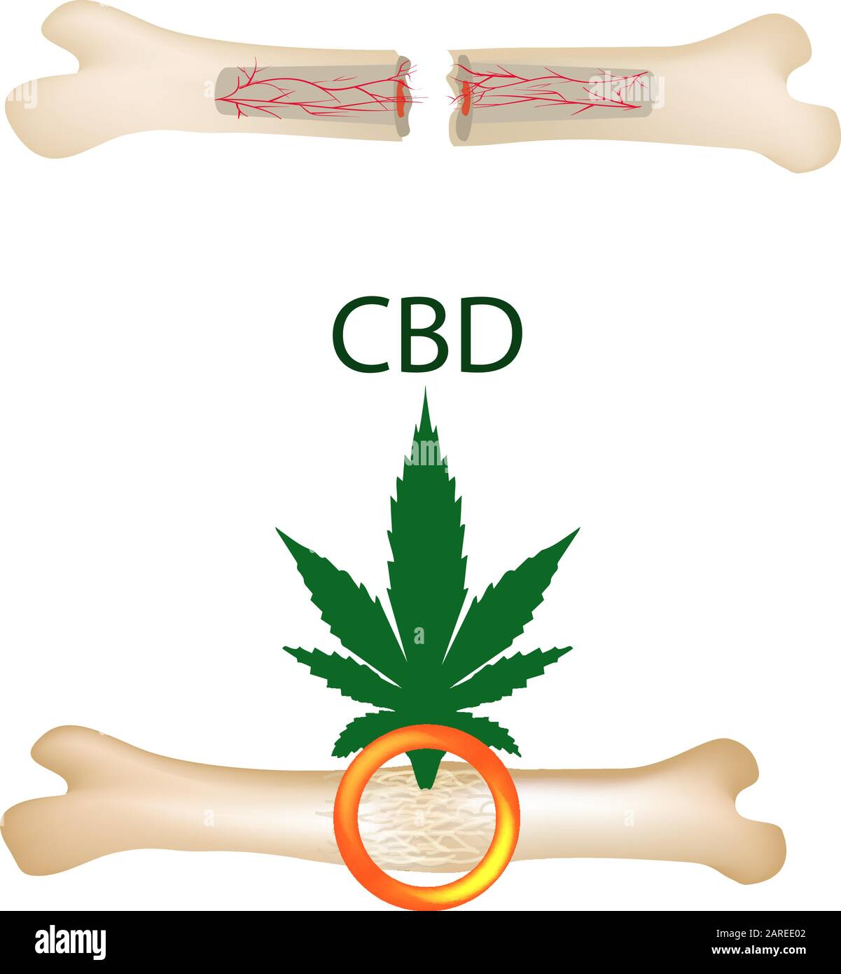 Effet de l'huile de cannabis sur les os et les fractures. Traitement des cannabinoïdes. Propriétés de marijuana. Illustration vectorielle sur un arrière-plan isolé. Illustration de Vecteur