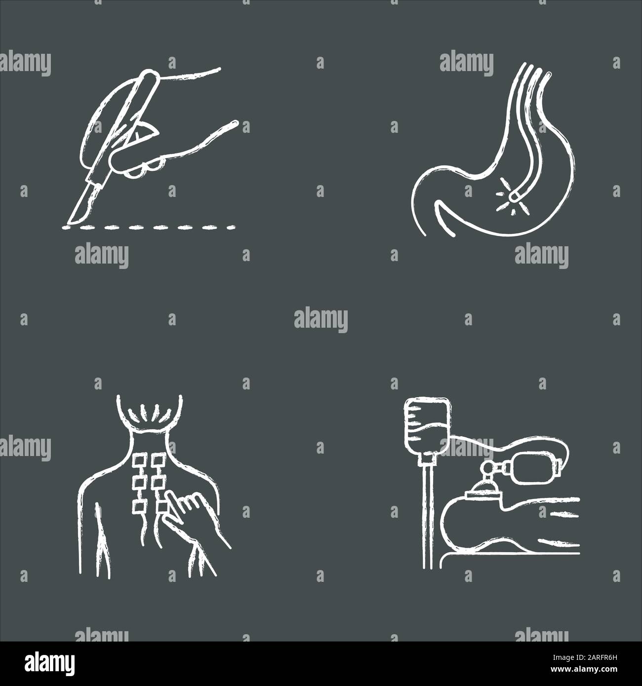 Jeu d'icônes de craie pour procédure médicale. Chirurgie. Endoscopie et gastroscopie. Contrôle du tube digestif. Physiothérapie. Soulagement de la douleur au dos. Anesthésie. Clinique ai Illustration de Vecteur