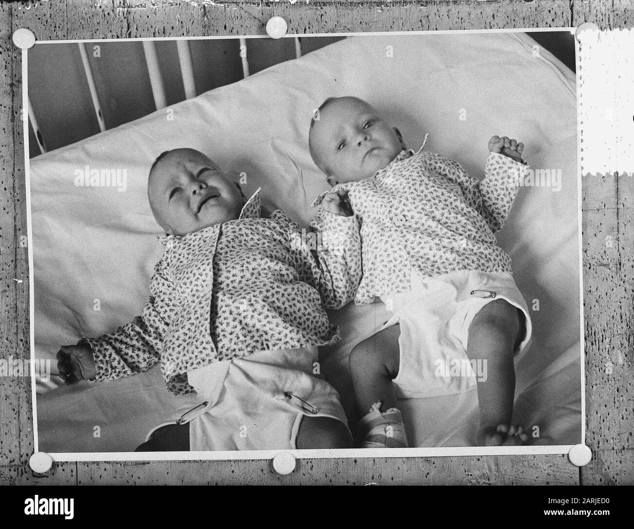 Siamese jumeaux Folkje en Tjitsske de Vries séparés avec succès par l'opération Date: 18 juin 1954 lieu: Friesland, Leeuwarden mots clés: Bébés, jumeaux, nourrissons Nom personnel: Vries , Folkje de, Vries, Tjitsske de Banque D'Images
