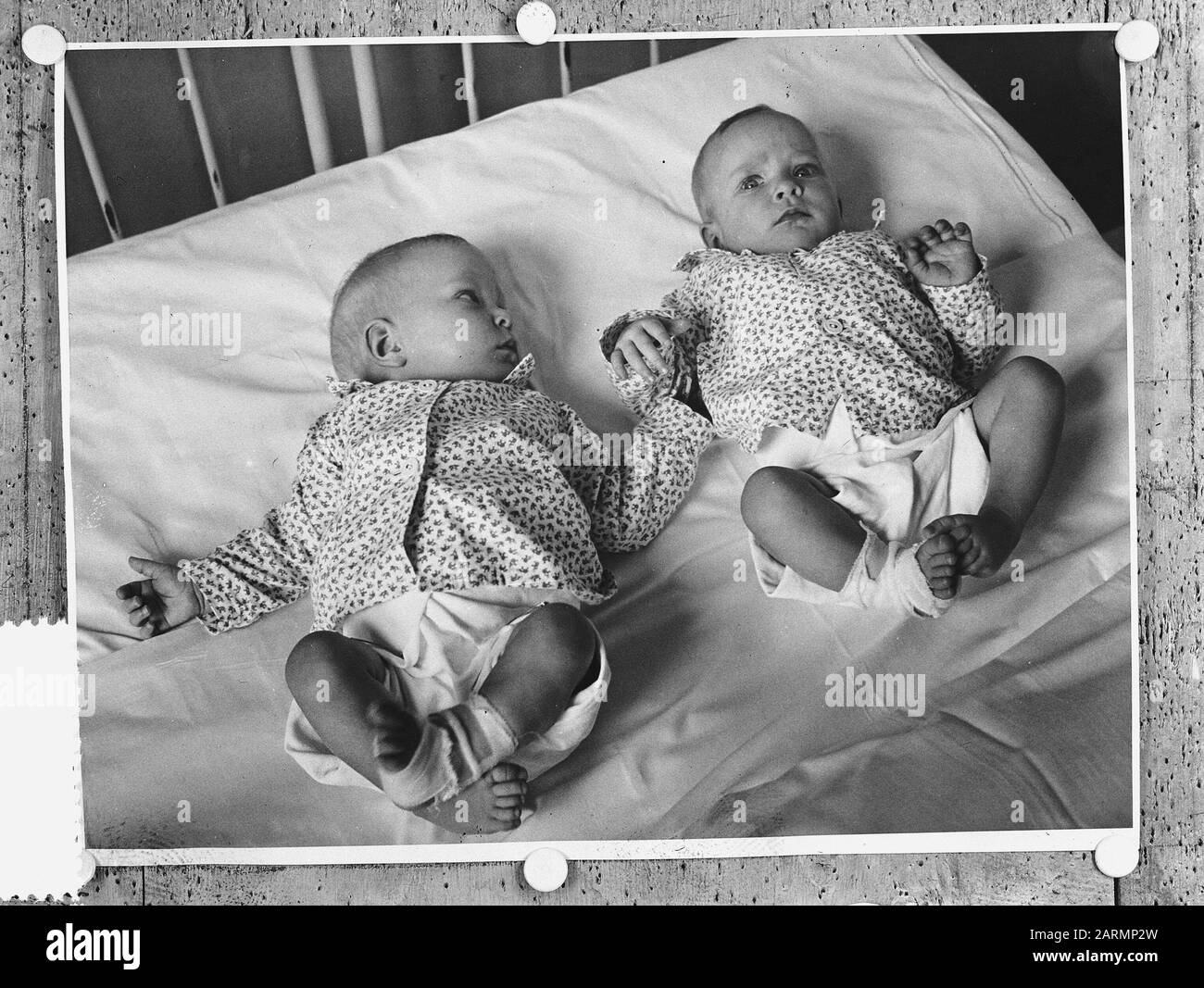 Siamese jumeaux Folkje en Tjitsske de Vries séparés avec succès par l'opération Date: 18 juin 1954 lieu: Friesland, Leeuwarden mots clés: Bébés, jumeaux, nourrissons Nom personnel: Vries , Folkje de, Vries, Tjitsske de Banque D'Images
