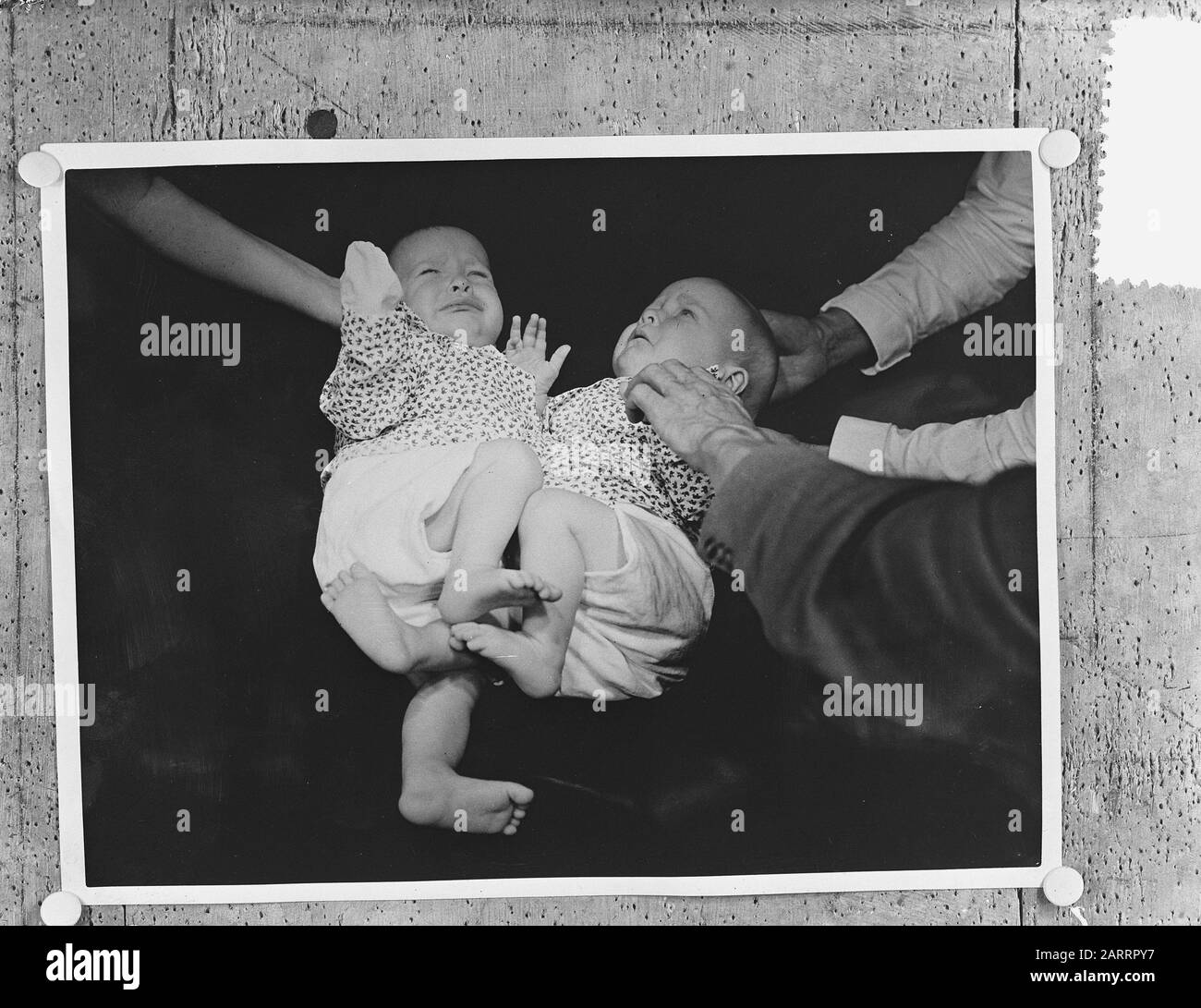 Siamese jumeaux Leeuwarden, gauche Folkje, droite Tjitsk Date: 13 juin 1954 lieu: Friesland, Leeuwarden mots clés: Jumeaux Nom personnel: Folkje, Vries, Tjitske de Banque D'Images