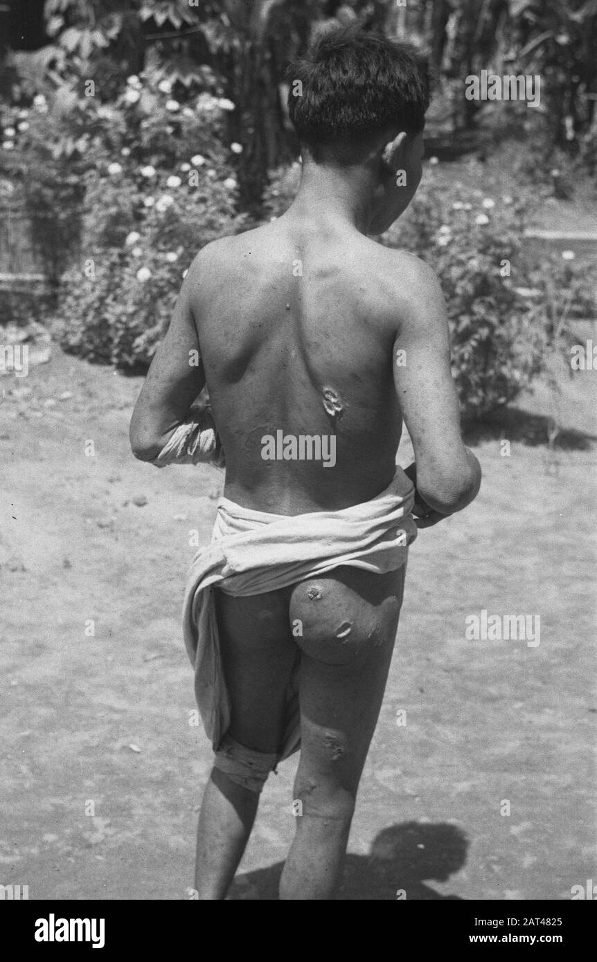 En vertu de l’article Hasty Emergency » population autochtone, affamée et sous les blessures Date : 29 juillet 1947 lieu : Indonésie, Antilles néerlandaises de l’est Banque D'Images