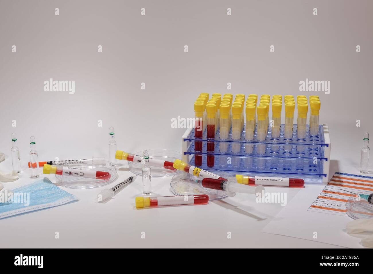 Test clinique de laboratoire de microbiologie Wuhan Coronavirus COVID-19 2019-nCoV. Équipements médicaux de laboratoire, y compris tubes de sang vacutainer sur portoir et seringues Banque D'Images