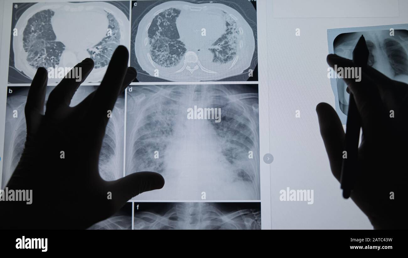Équipe médicale professionnelle examinant la radiographie d'un patient, concept médical. Banque D'Images